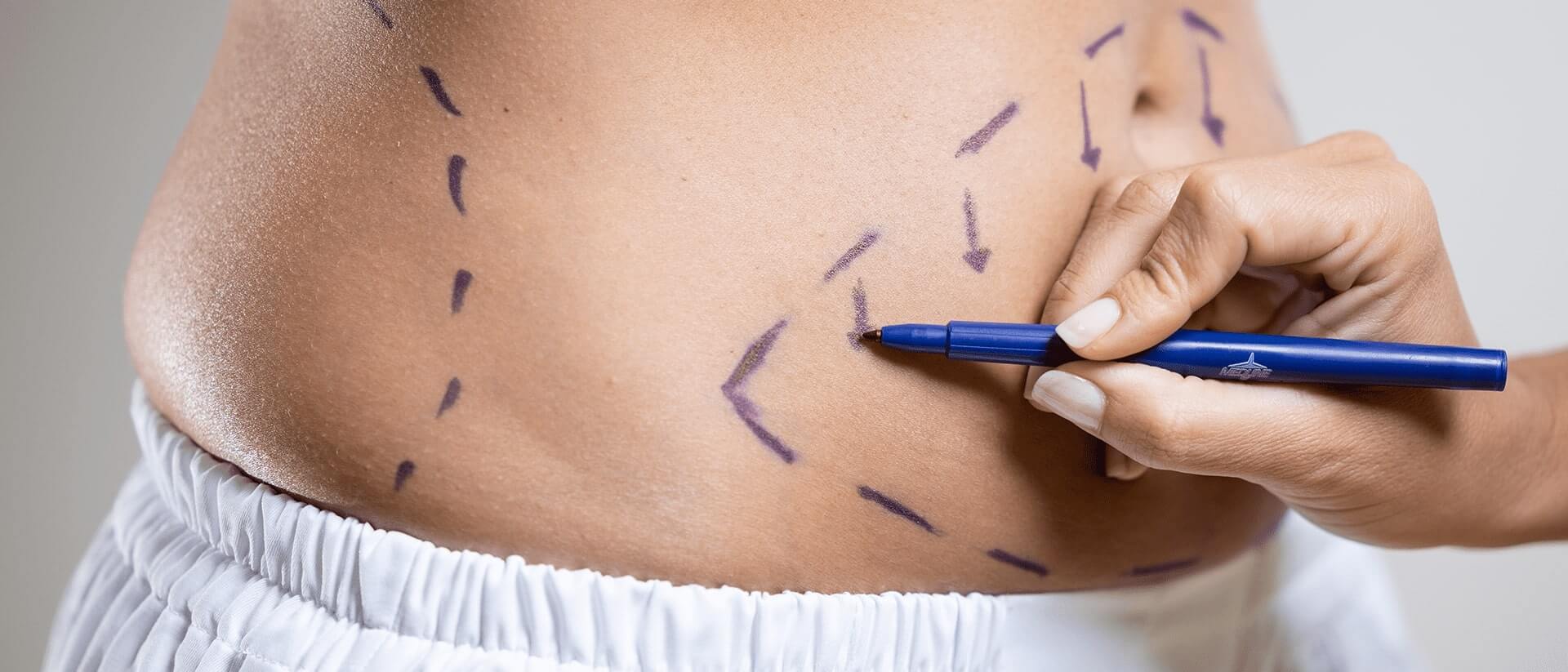 CIRURGIA PLÁSTICA E RESCONSTRUTIVA - DR THIAGO SOUZA