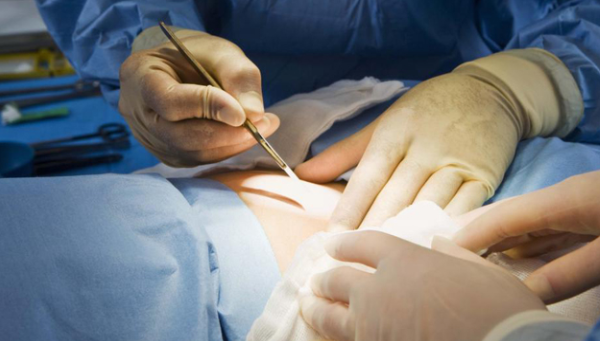 CIRURGIA GERAL - DR. JAVERT