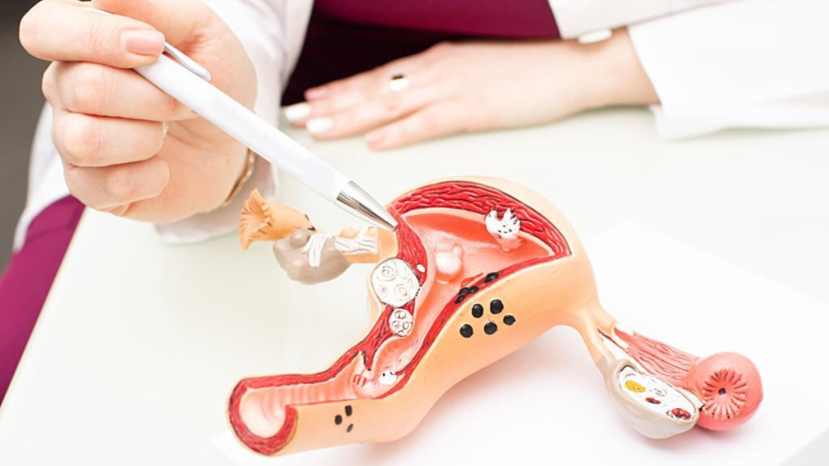 GINECOLOGIA E OBSTETRÍCIA - DRa. ELAINE ARAÚJO