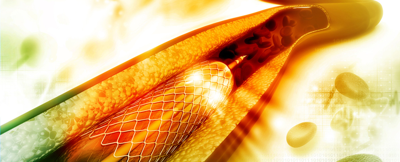 CIRURGIA VASCULAR E ENDOVASCULAR - DR. ARNO VON RISTOW