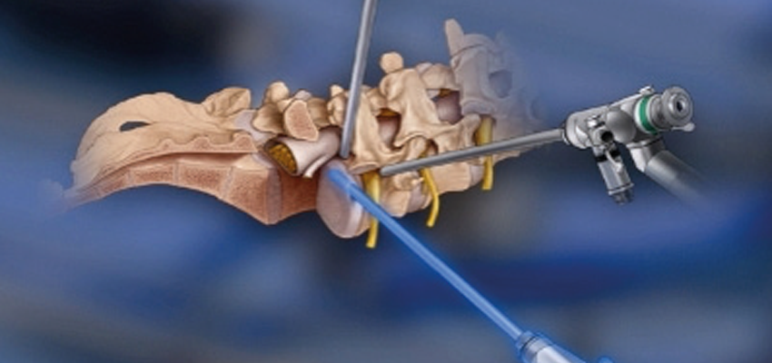 CIRURGIA DA COLUNA VERTEBRAL - DR VINÍCIUS MAGNO