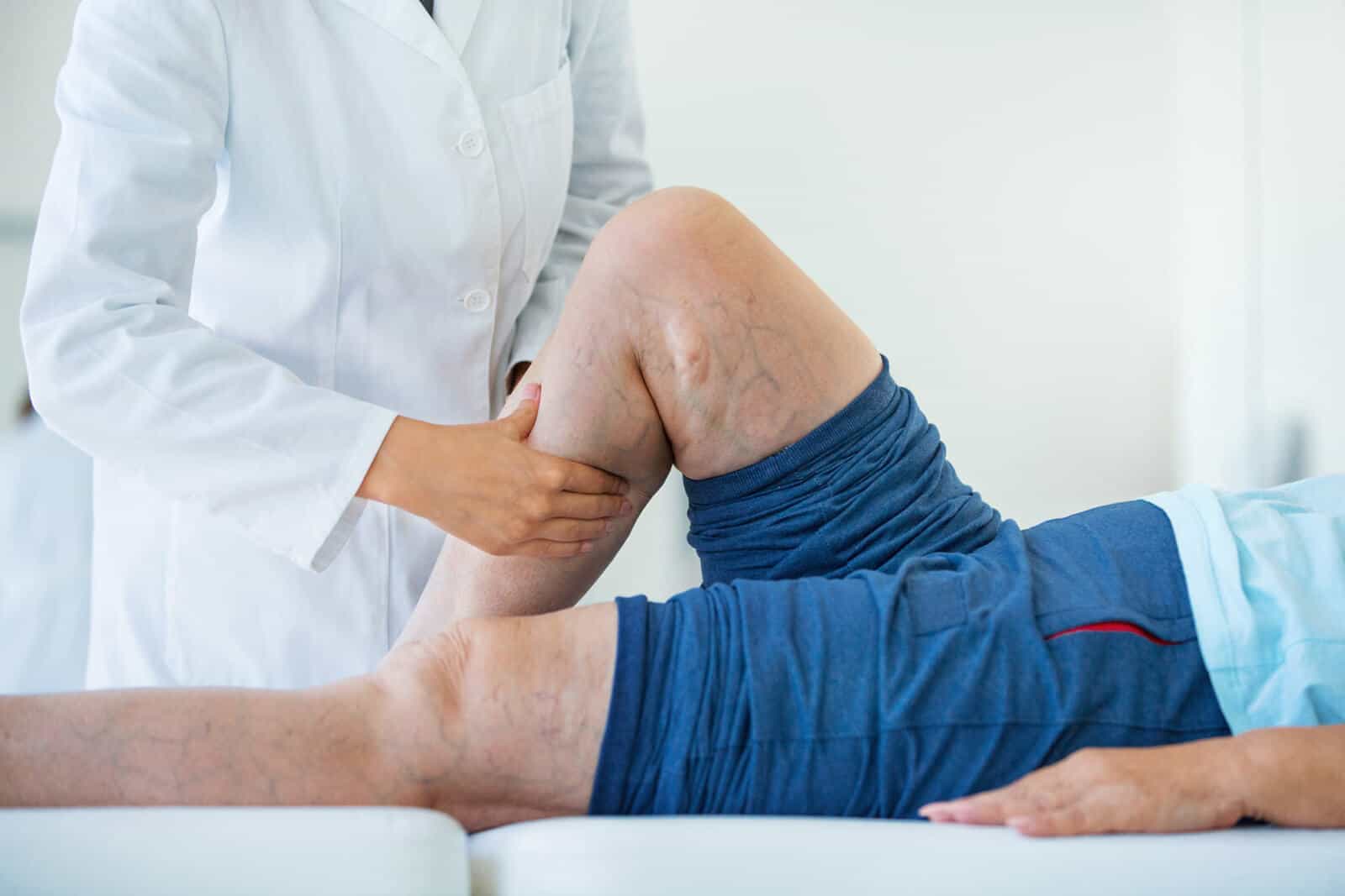 ANGIOLOGIA/CIRURGIA VASCULAR E ENDOVASCULAR - DR ROSSI